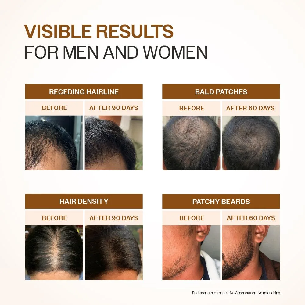 Bare Anatomy Advanced Hair Growth Serum image 12